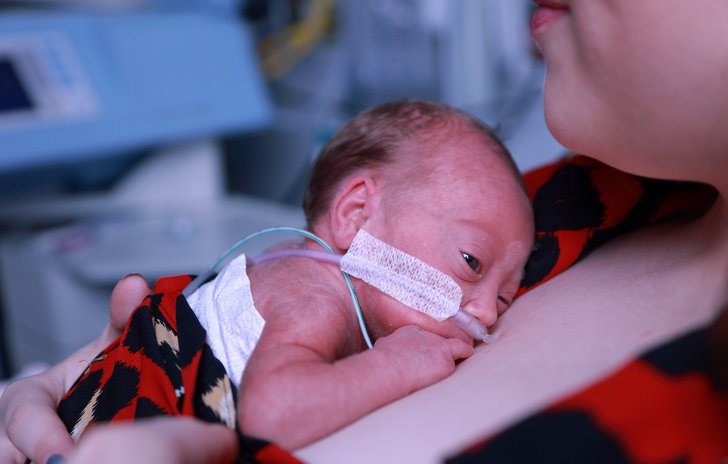 Neonatal Baby
